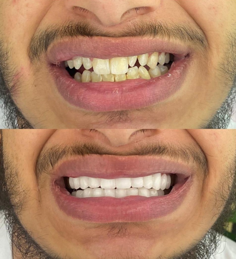 Dental Care