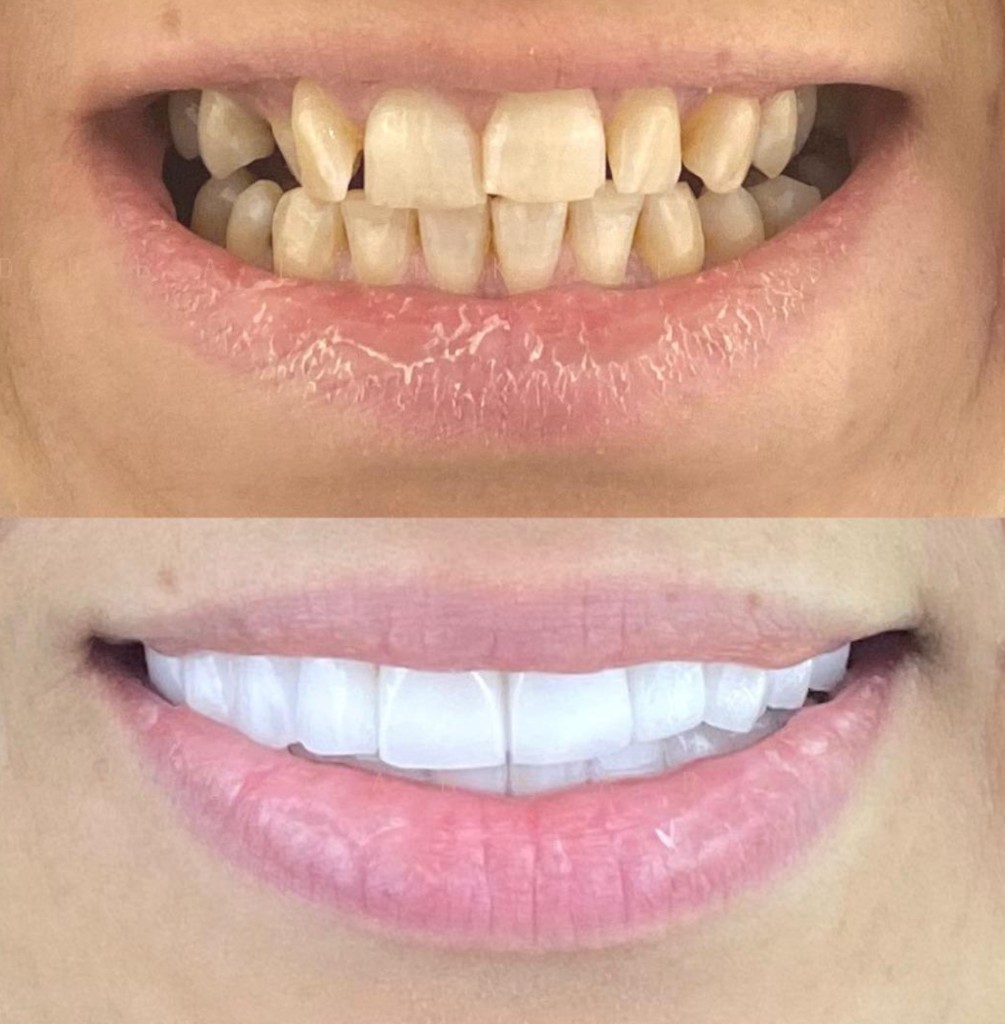 Dental Care care path, Estefulya Global